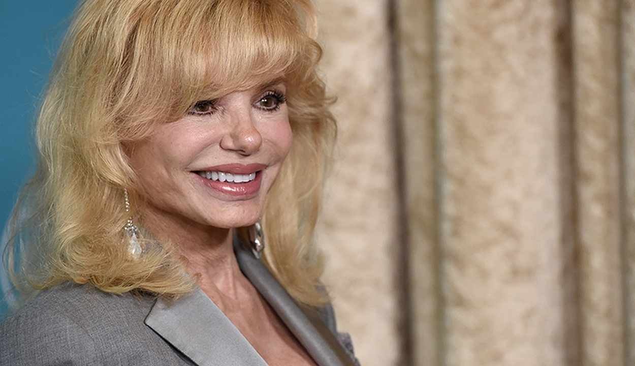 Loni anderson